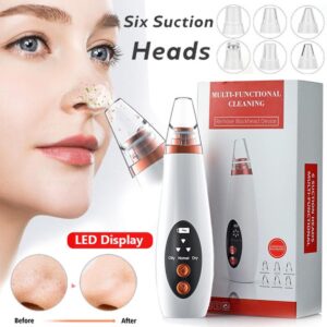 Rechargeable Device for Removing Blackheads and Whiteheads for Men and Women